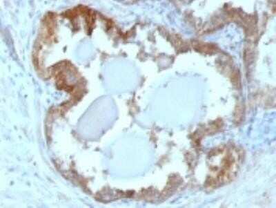 Immunohistochemistry-Paraffin: HSP27 Antibody (G3.1) - IHC-Prediluted [NBP2-44973]