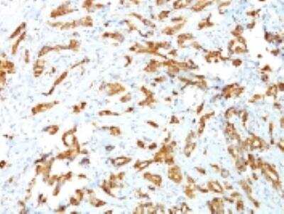 Immunohistochemistry-Paraffin: HSP27 Antibody (G3.1) [NBP2-32972]