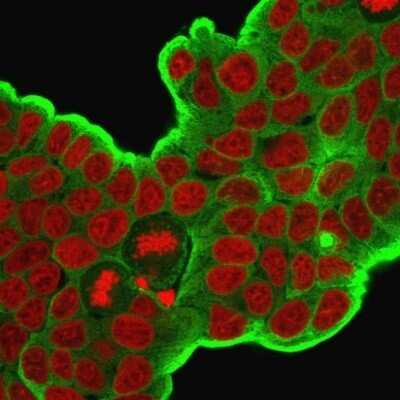 Immunocytochemistry/ Immunofluorescence: HSP27 Antibody (HSPB1/774) - Azide and BSA Free [NBP2-48002]