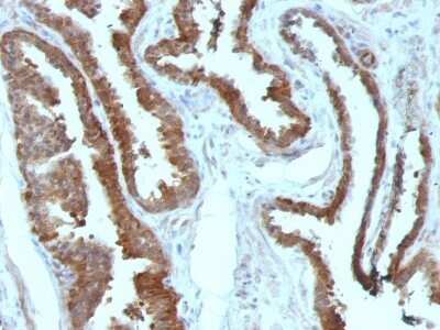 Immunohistochemistry-Paraffin: HSP27 Antibody (HSPB1/774) - Azide and BSA Free [NBP2-48002]