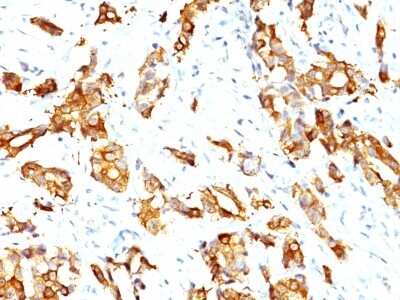 Immunohistochemistry-Paraffin: HSP27 Antibody (HSPB1/774) [NBP2-44975]