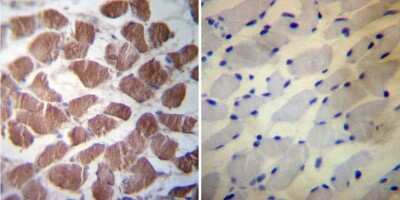 Immunohistochemistry-Paraffin: HSP27 Antibody [NB120-5579]