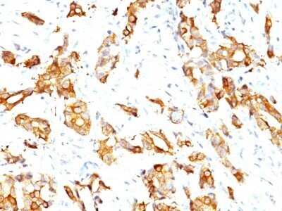 Immunohistochemistry-Paraffin: HSP27 Antibody (SPM252) - Azide and BSA Free [NBP2-34751]