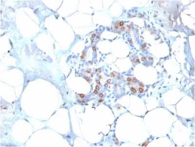 Immunohistochemistry-Paraffin: HSP27 Antibody (SPM252) - Azide and BSA Free [NBP2-34751]