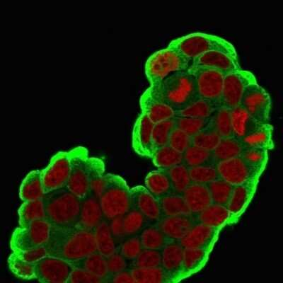Immunocytochemistry/ Immunofluorescence: HSP27 Antibody (SPM252) [NBP2-32865]