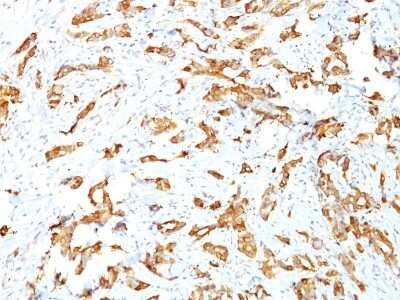 Immunohistochemistry-Paraffin: HSP27 Antibody (SPM252) [NBP2-32865]