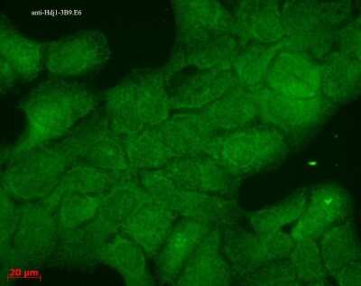 Immunohistochemistry-Paraffin: HSP40/DNAJB1 Antibody (3B9.E6) [NBP2-12876]
