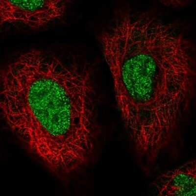 Immunocytochemistry/ Immunofluorescence: HSP40/DNAJB1 Antibody [NBP2-38988]