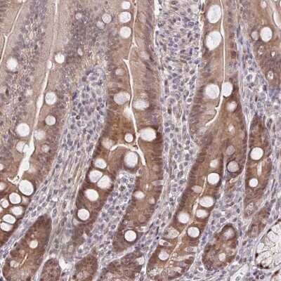 Immunohistochemistry-Paraffin: HSP40/DNAJB1 Antibody [NBP2-38988]