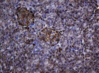 Immunohistochemistry: HSP60 Antibody (OTI3A2) [NBP2-46008]