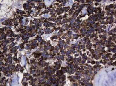 Immunohistochemistry: HSP60 Antibody (OTI3A2) [NBP2-46008]