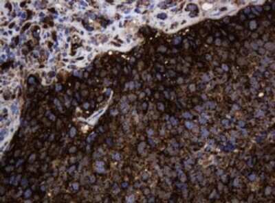 Immunohistochemistry: HSP60 Antibody (OTI3A2) [NBP2-46008]