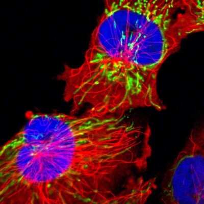 Immunocytochemistry/ Immunofluorescence: HSP60 Antibody [NBP1-89730]