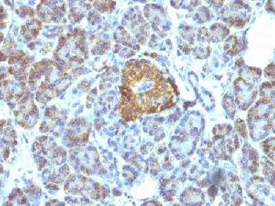 Immunohistochemistry-Paraffin: HSP60 Antibody (LK1) [NBP2-32973]