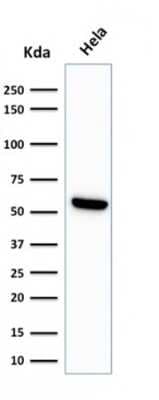 Western Blot: HSP60 Antibody (LK1) [NBP2-32973]