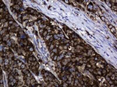 Immunohistochemistry: HSP60 Antibody (OTI3A2) - Azide and BSA Free [NBP2-70967]