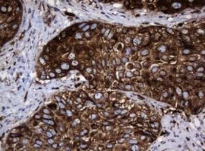 Immunohistochemistry: HSP60 Antibody (OTI3A2) - Azide and BSA Free [NBP2-70967]