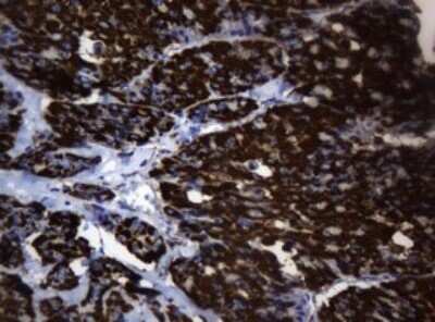 Immunohistochemistry: HSP60 Antibody (OTI3A2) - Azide and BSA Free [NBP2-70967]