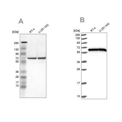 Western Blot: HSP60 Antibody [NBP1-89730]