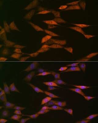 Immunocytochemistry/ Immunofluorescence: HSP70/HSPA1A Antibody (5U9A0) [NBP3-16482]