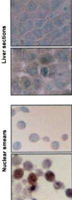 Immunohistochemistry: HSP70/HSPA1A Antibody (BB70) [NB110-96427]