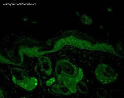 Immunohistochemistry: HSP70/HSPA1A Antibody (N27F3-4) [NB110-96425]
