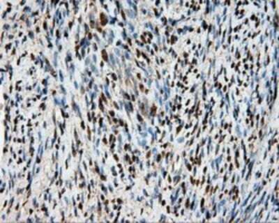 Immunohistochemistry: HSP70/HSPA1A Antibody (OTI3G9) - Azide and BSA Free [NBP2-70954]