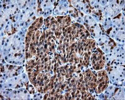 Immunohistochemistry: HSP70/HSPA1A Antibody (OTI3G9) - Azide and BSA Free [NBP2-70954]