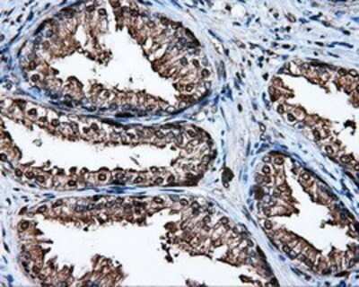 Immunohistochemistry: HSP70/HSPA1A Antibody (OTI3G9) - Azide and BSA Free [NBP2-70954]