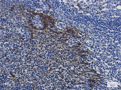 Immunohistochemistry-Paraffin: HSP70/HSPA1A Antibody (S01-6H6) [NBP3-19657]