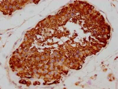 Immunohistochemistry: HSP90 Antibody (4B5) [NBP3-15145]