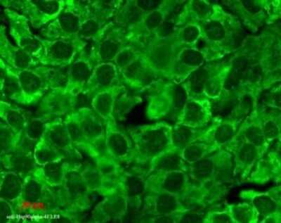 Immunocytochemistry/ Immunofluorescence: HSP90 Antibody (4F3.E8) [NBP2-12878]