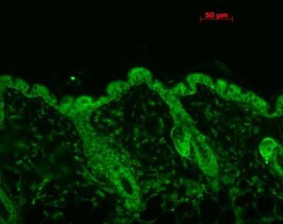 Immunohistochemistry: HSP90 Antibody (4F3.E8) [NBP2-12878]