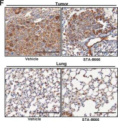 Immunohistochemistry-Paraffin: HSP90 alpha Antibody [NB120-2928]