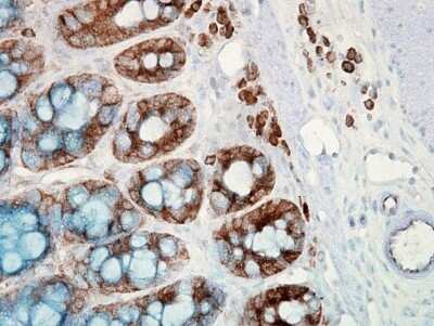 Immunohistochemistry: HSP90 beta Antibody (H9010) [NB110-61640]