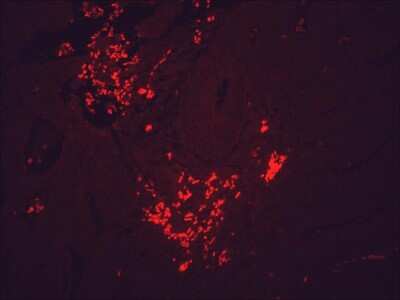Immunohistochemistry: HSP90 beta Antibody (H9010) [NB110-61640]