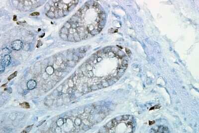 Immunohistochemistry: HSP90 beta Antibody (H9010) [NB110-61640]