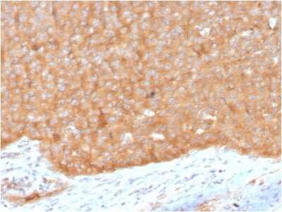 Immunohistochemistry-Paraffin: HSP90 beta Antibody (HSP90AB1/3951) - Azide and BSA Free [NBP3-08930]