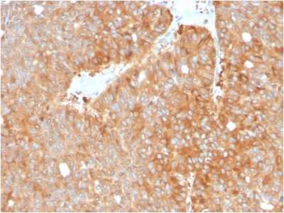 Immunohistochemistry-Paraffin: HSP90 beta Antibody (HSP90AB1/3952) - Azide and BSA Free [NBP3-08931]