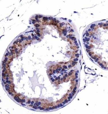 Immunohistochemistry: HSP90 beta Antibody - BSA Free [NBP1-77561]