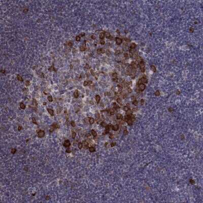 Immunohistochemistry: HSP90 beta Antibody [NBP2-68978]