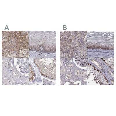 Immunohistochemistry-Paraffin: HSP90 beta Antibody [NBP2-68937]