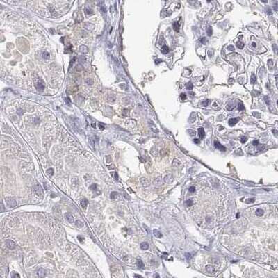 Immunohistochemistry-Paraffin: HSP90 beta Antibody [NBP2-68937]