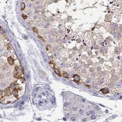 Immunohistochemistry-Paraffin: HSP90 beta Antibody [NBP2-68937]