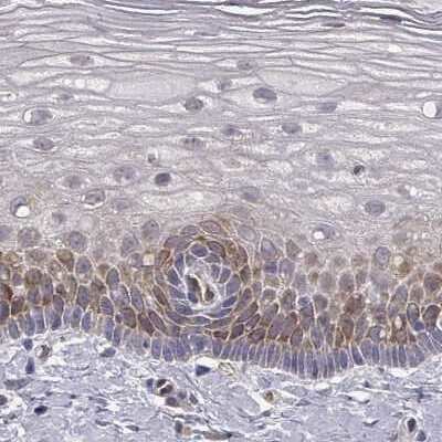 Immunohistochemistry-Paraffin: HSP90 beta Antibody [NBP2-68937]