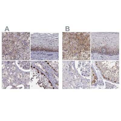 Immunohistochemistry-Paraffin: HSP90 beta Antibody [NBP2-68978]