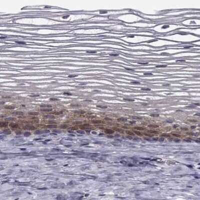 Immunohistochemistry-Paraffin: HSP90 beta Antibody [NBP2-68978]