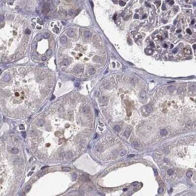 Immunohistochemistry-Paraffin: HSP90 beta Antibody [NBP2-68978]
