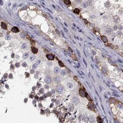 Immunohistochemistry-Paraffin: HSP90 beta Antibody [NBP2-68978]