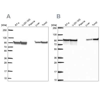 Western Blot: HSP90 beta Antibody [NBP2-55509]